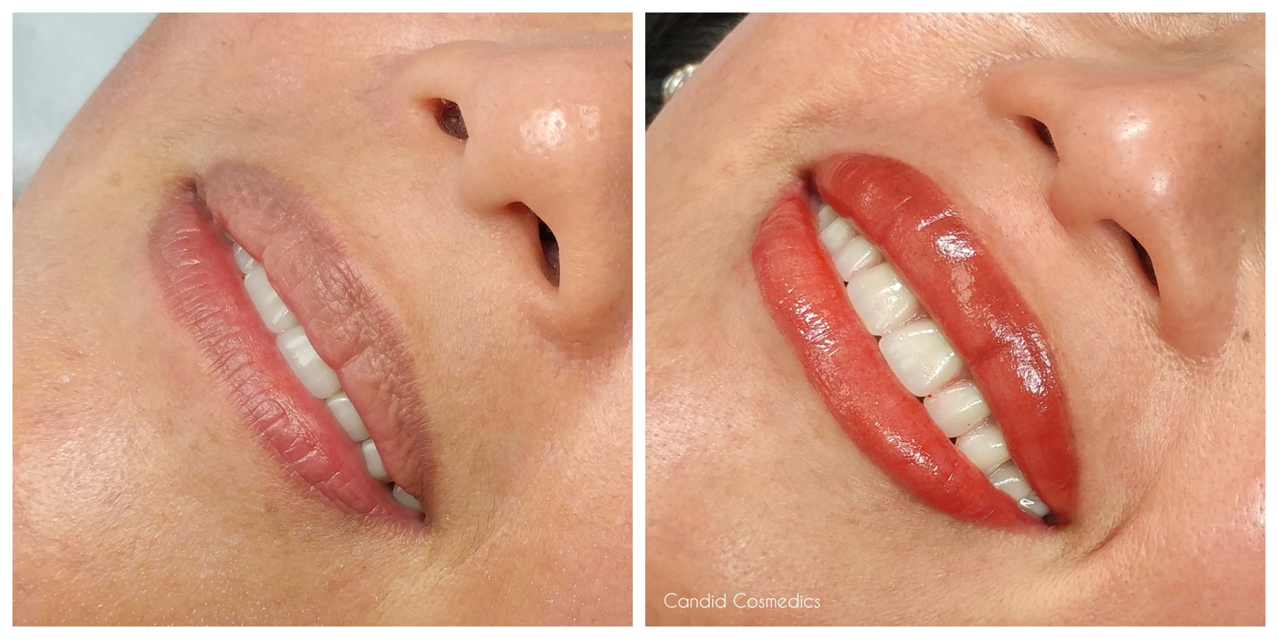 All That You Need To Know About Lip Tattoos - Aftercare And Risks 2 All That You Need To Know About Lip Tattoos - Aftercare And Risks Top Beauty Magazines